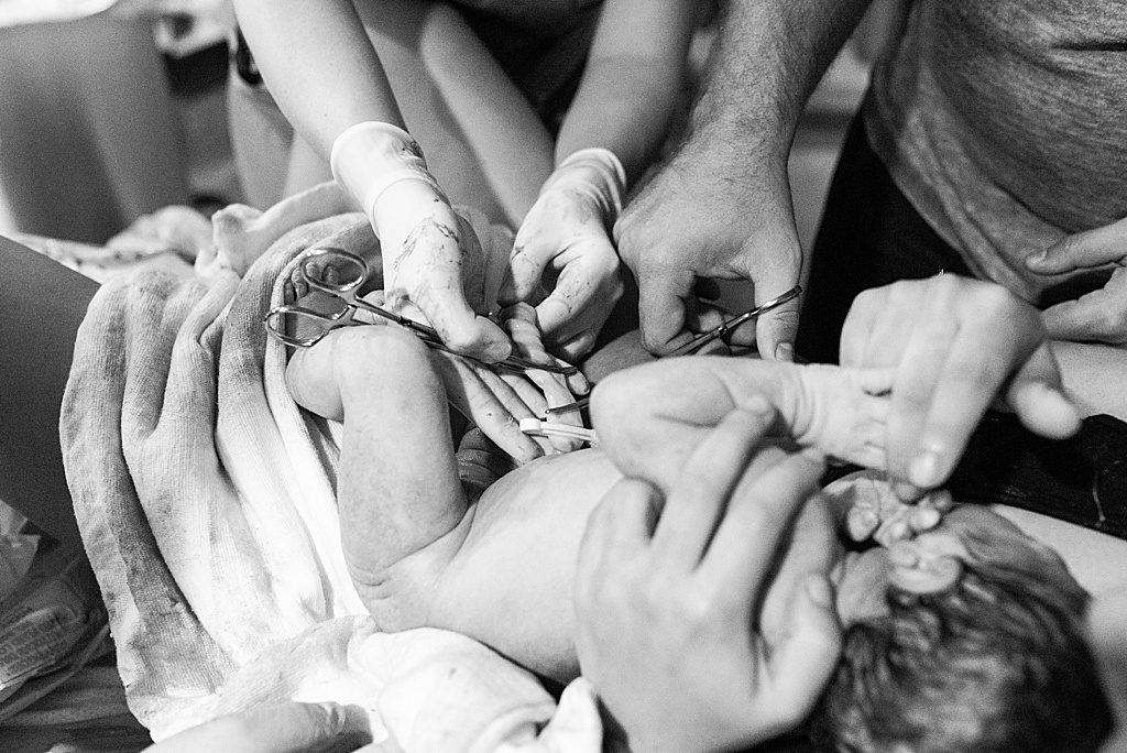 dad cutting umbilical cord, hospital birth